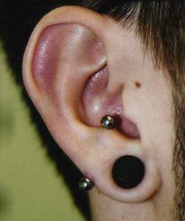 12 gauge transverse lobe