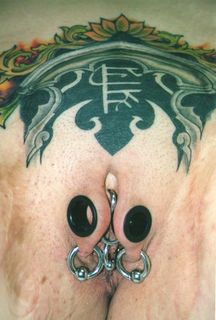 multiple labia majora