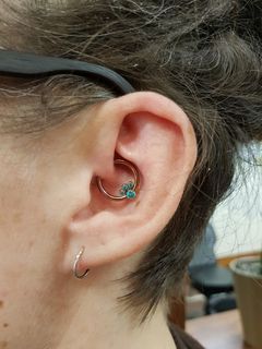 14 gauge daith