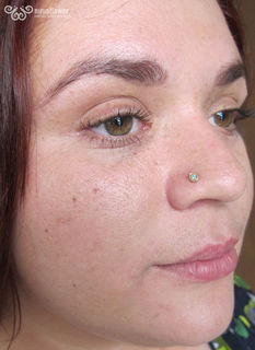 18 gauge nostril