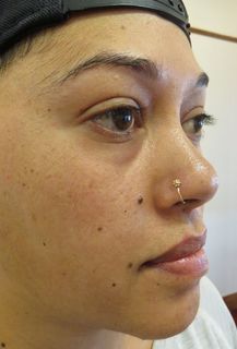 18 gauge nostril