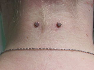 14gauge nape surface