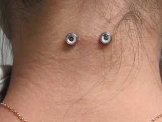 14gauge nape surface