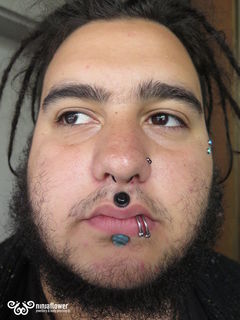 2gauge philtrum
