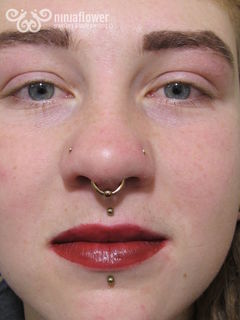 14gauge philtrum