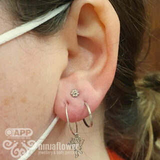 Single Stacked Lobe.
