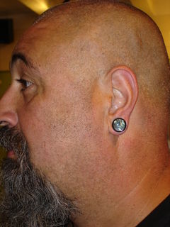 1/2 Lobe