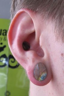 1/2 Lobe