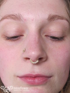 16 gauge septum