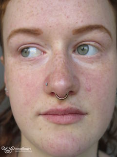 14 gauge septum